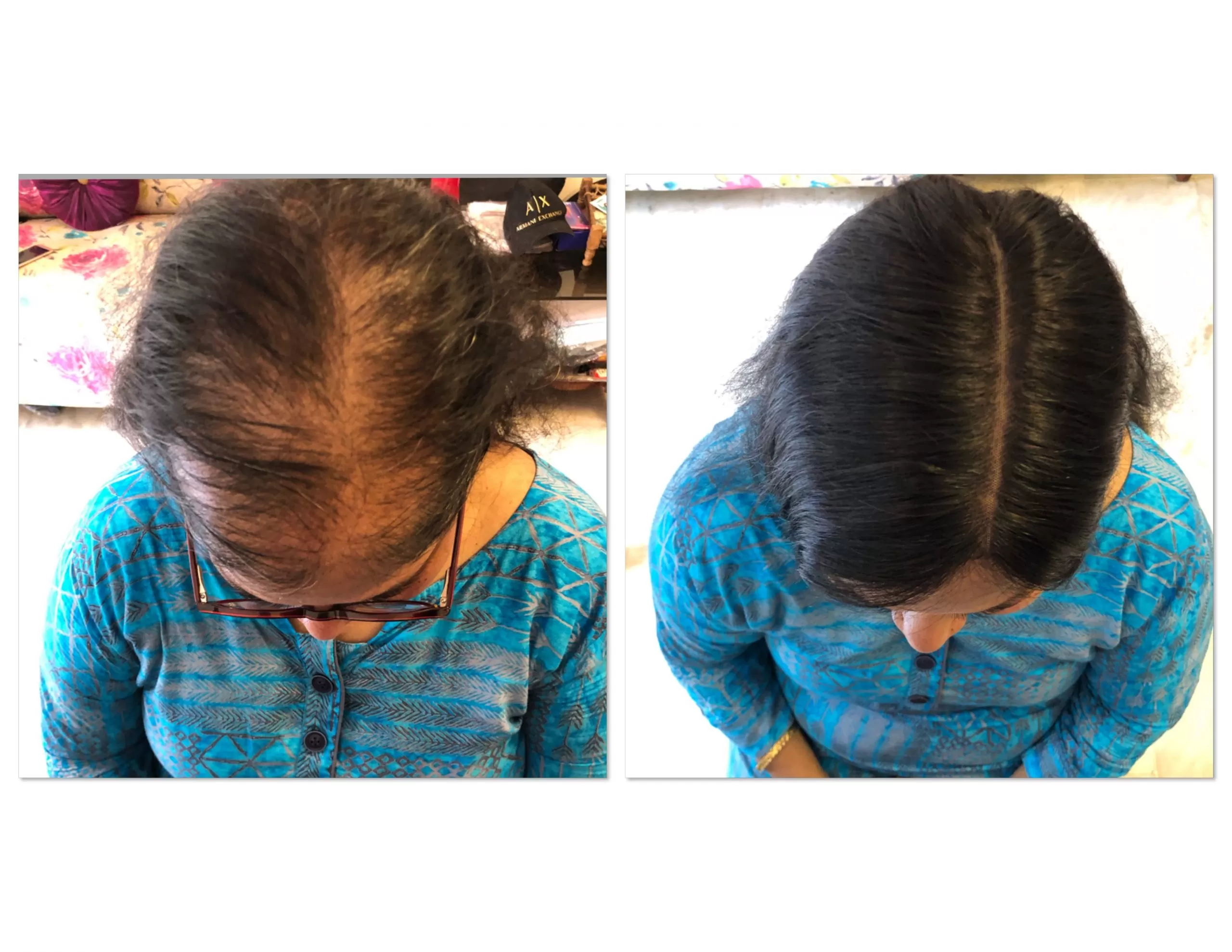 Lace Base Faux Scalp™ – Hair Topper 2x6inch - Image 5